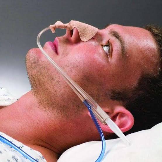 Ryles Tube Insertion